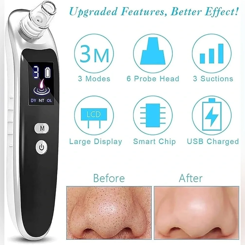 Electric Blackhead Remover Vacuum NEW IN BOX – IHFMPFKJ
